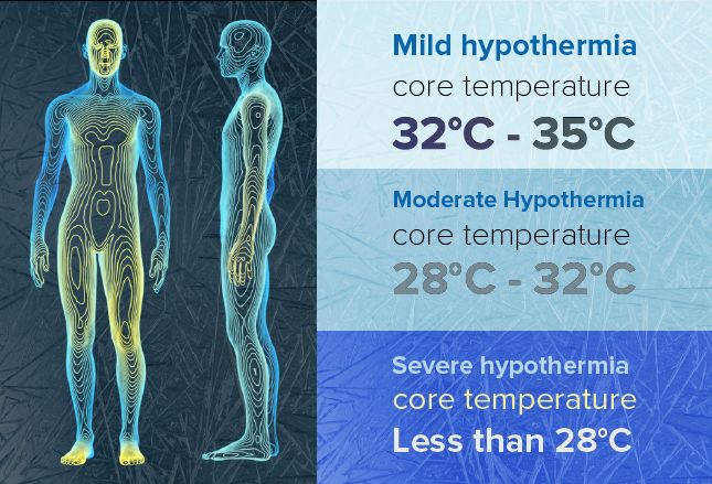 طبقه بندی هایپوترمی Hypothermia classification